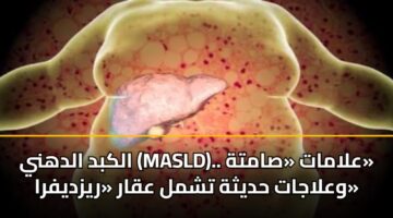 alkbd aldhny masld. alamat samth walajat hdythh tshml aqar ryzdyfra