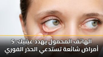 alhatf almhmwl yhdd aynyk 5 amrad shaah tstday alhdhr alfwry